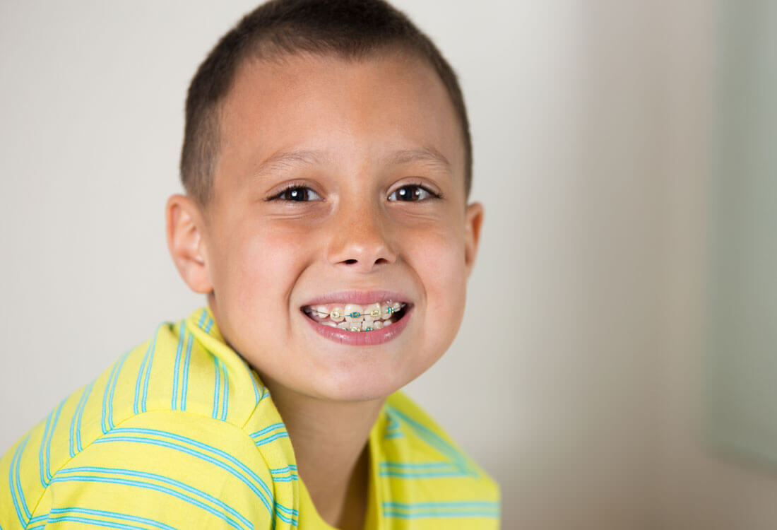 Early Orthodontic Treatment
