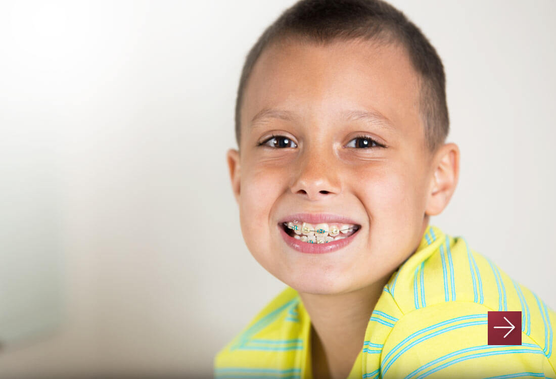 Early Orthodontic Treatment